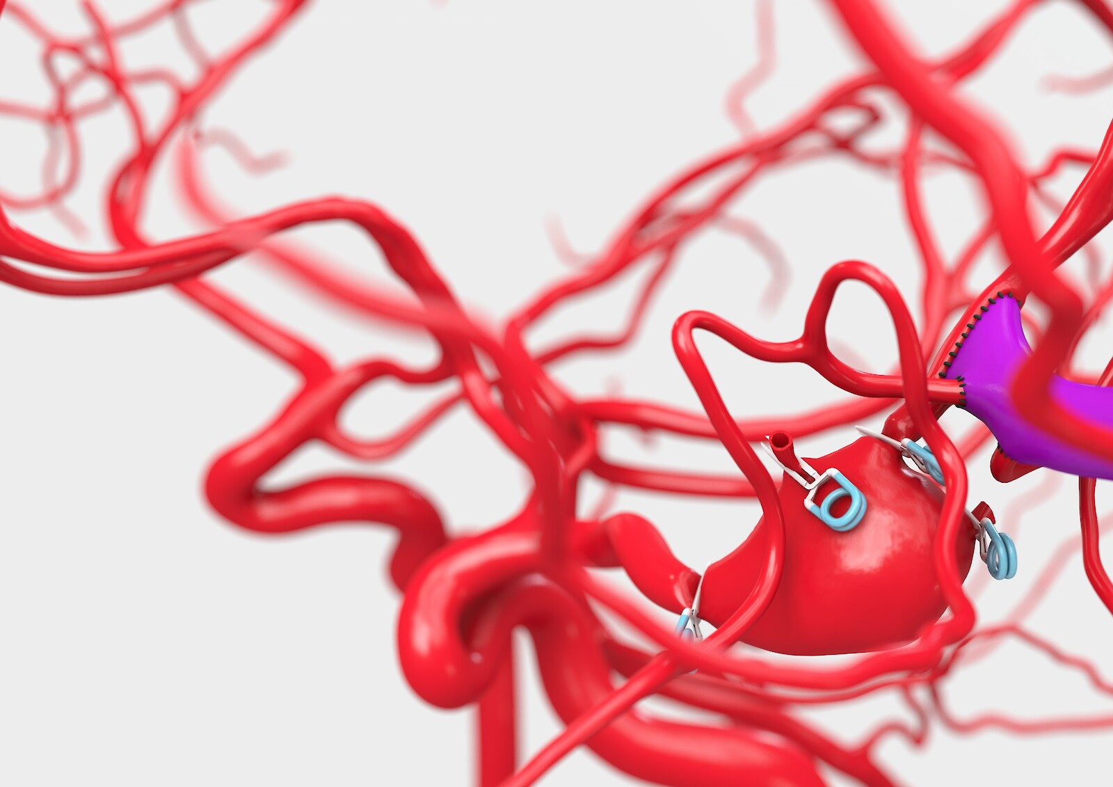 Gyri, Sulci et Arteriae