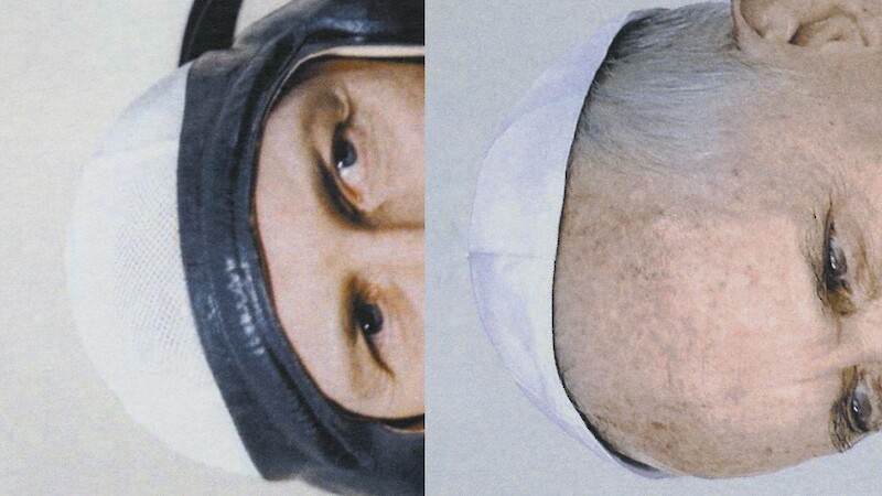 On the Head, about the Hat